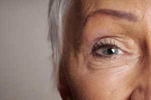 close up of older woman's eye with smooth skin after learning how to remove wrinkles under eyes